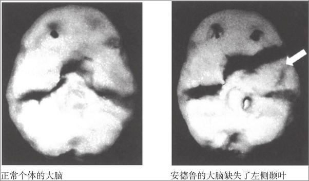 书籍《幸福脑：助你摆脱烦人的情绪和行为问题》 - 插图2