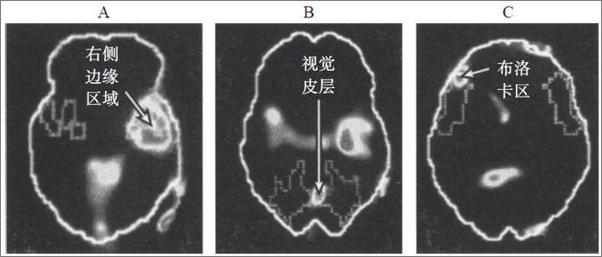 书籍《身体从未忘记：心理创伤疗愈中的大脑、心智和身体》 - 插图2