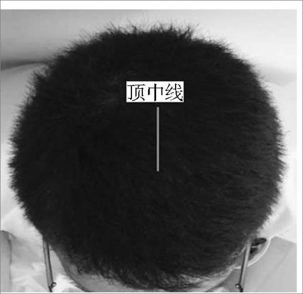 书籍《社区适宜中医技术》 - 插图1