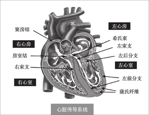 书籍《心律失常•安装心脏起搏器》 - 插图1