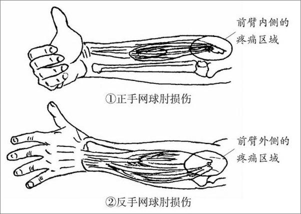 书籍《一本书读懂颈肩腰腿痛》 - 插图1